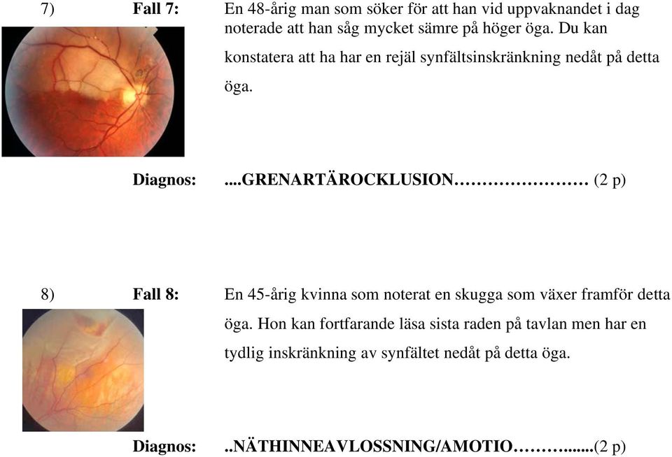 p) 8) Fall 8: En 45-årig kvinna som noterat en skugga som växer framför detta öga Hon kan fortfarande läsa sista