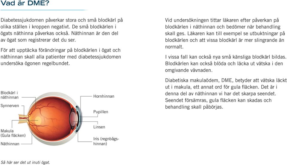 Vid undersökningen tittar läkaren efter påverkan på blodkärlen i näthinnan och bedömer när behandling skall ges.