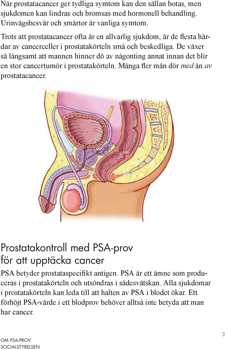 De växer så långsamt att mannen hinner dö av någonting annat innan det blir en stor cancertumör i prostatakörteln. Många fler män dör med än av prostatacancer.