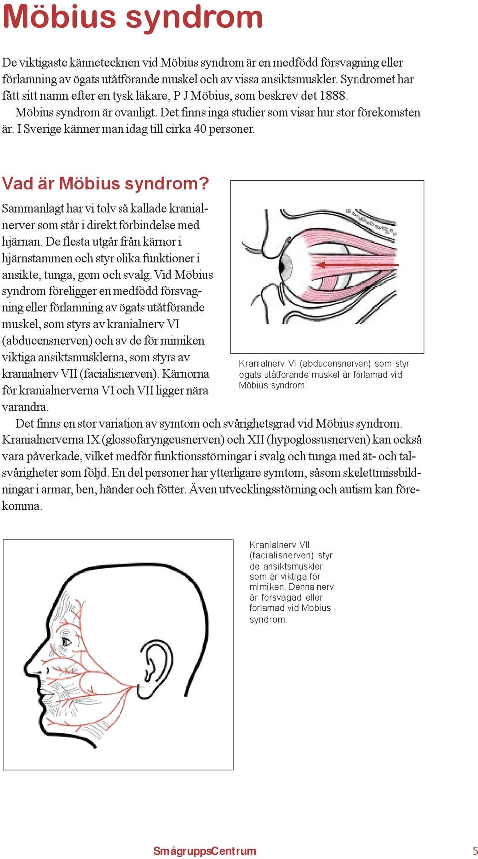 I Sverige känner man idag till cirka 40 personer. Vad är Möbius syndrom? Sammanlagt har vi tolv så kallade kranialnerver som står i direkt förbindelse med hjärnan.