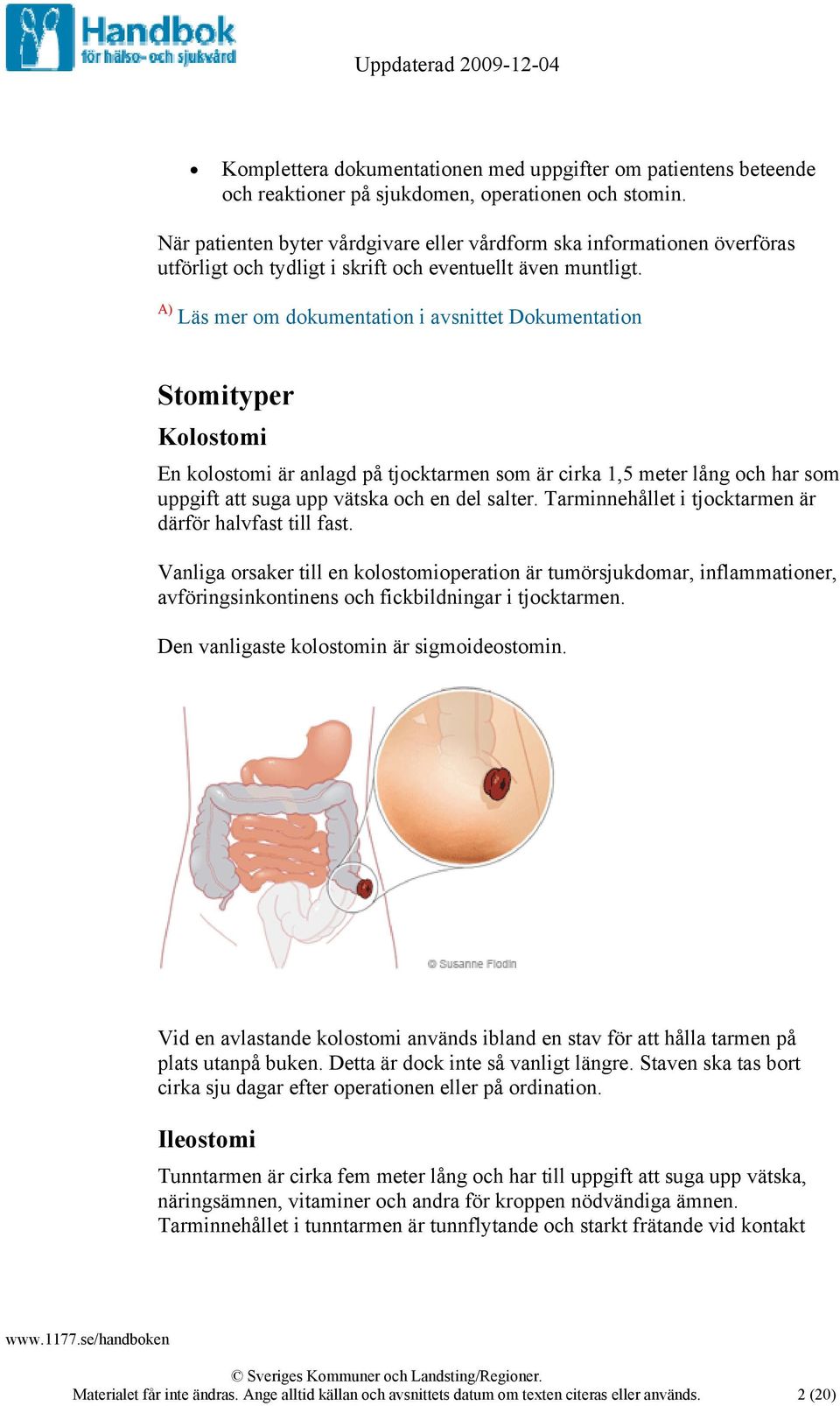 A) Läs mer om dokumentation i avsnittet Dokumentation Stomityper Kolostomi En kolostomi är anlagd på tjocktarmen som är cirka 1,5 meter lång och har som uppgift att suga upp vätska och en del salter.