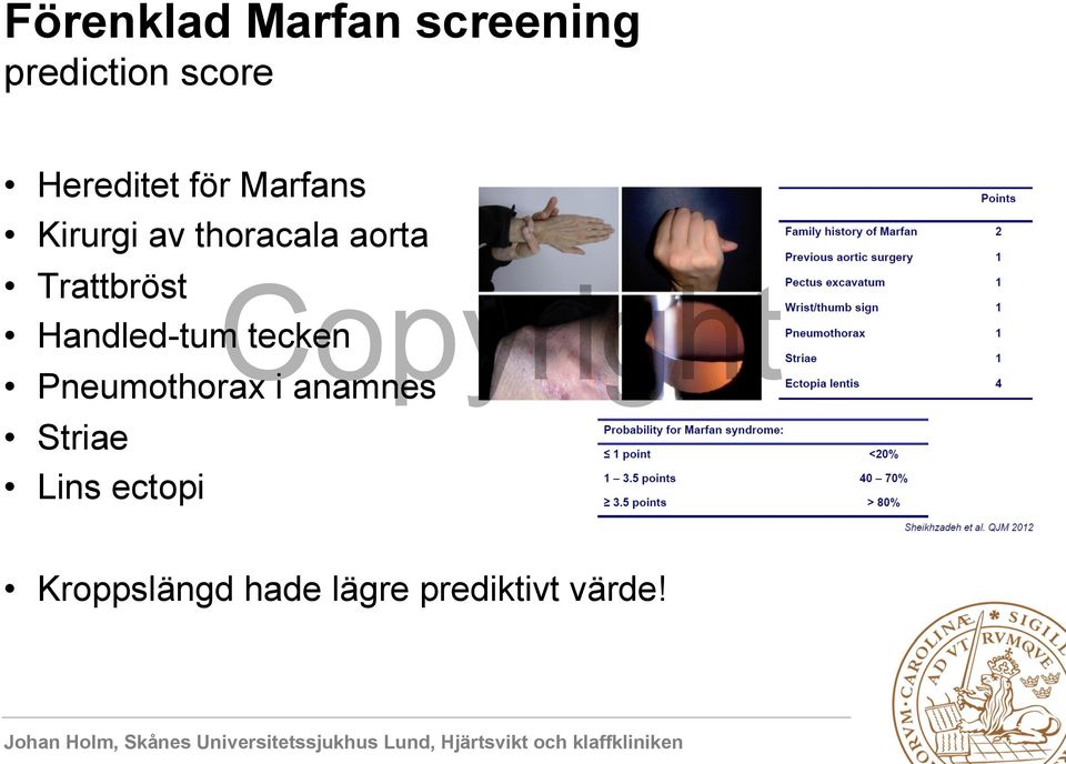 Trattbröst Handled-tum tecken Pneumothorax i