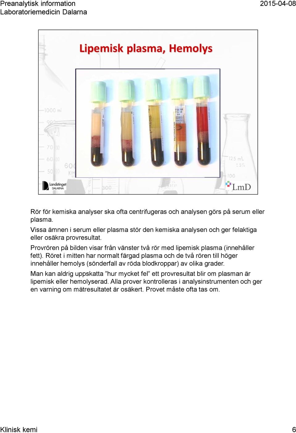 Provrören på bilden visar från vänster två rör med lipemisk plasma (innehåller fett).