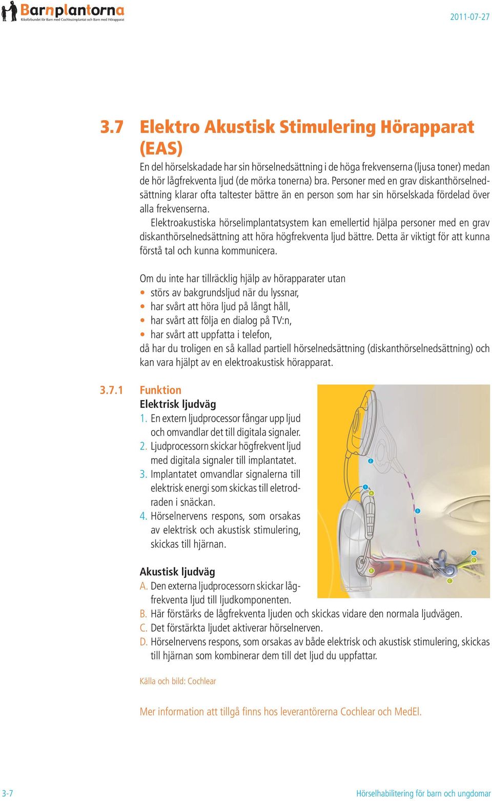 Elektroakustiska hörselimplantatsystem kan emellertid hjälpa personer med en grav diskanthörselnedsättning att höra högfrekventa ljud bättre.