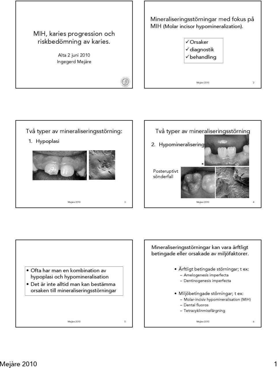 Hypomineralisering Posteruptivt sönderfall Mejàre 2010 3 Mejàre 2010 4 Mineraliseringsstörningar kan vara ärftligt betingade eller orsakade av miljöfaktorer.