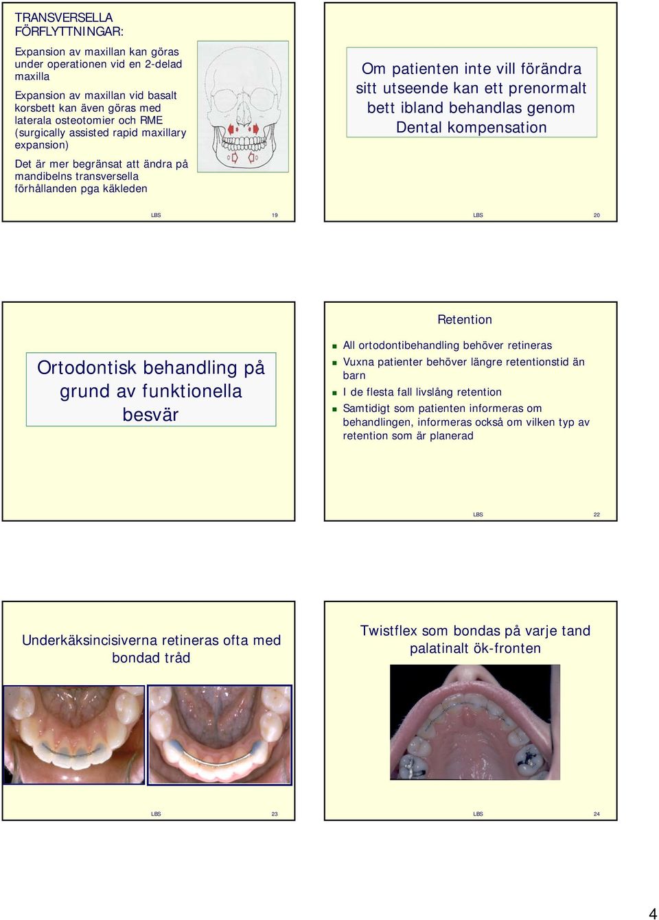 mandibelns transversella förhållanden pga käkleden 19 20 Retention All ortodontibehandling behöver retineras Ortodontisk behandling på grund av funktionella besvär Vuxna patienter behöver längre