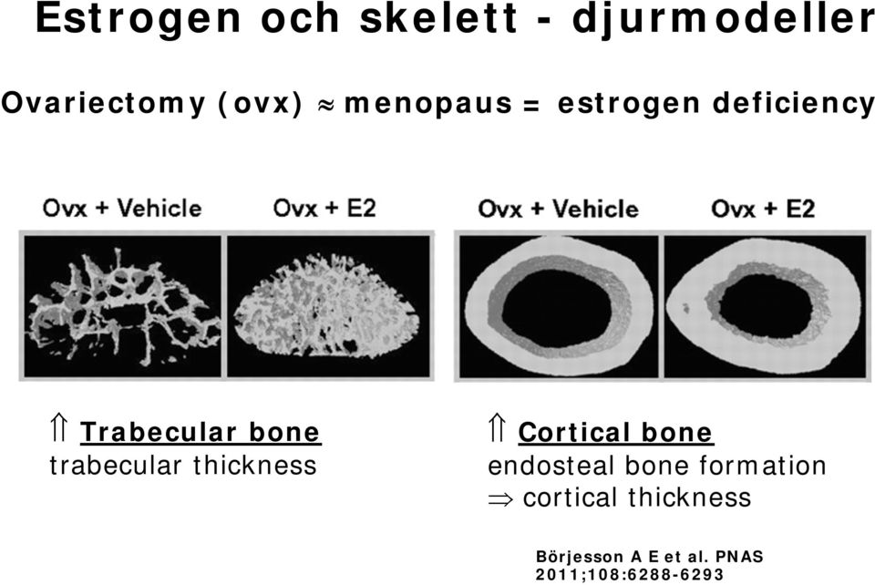 trabecular thickness Cortical bone endosteal bone