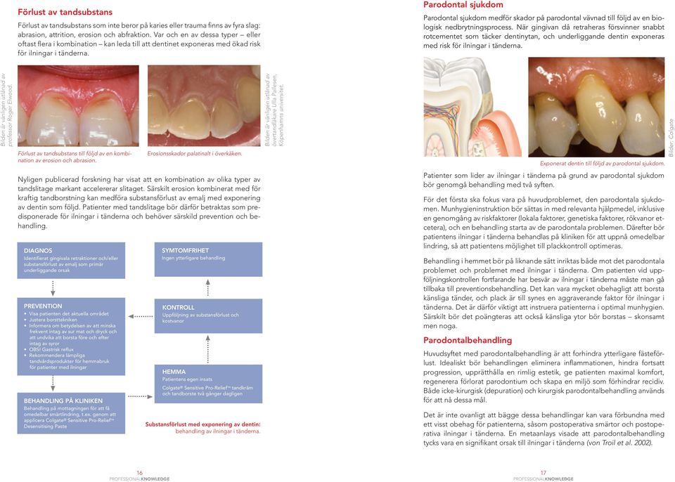 Parodontal sjukdom Parodontal sjukdom medför skador på parodontal vävnad till följd av en biologisk nedbrytningsprocess.