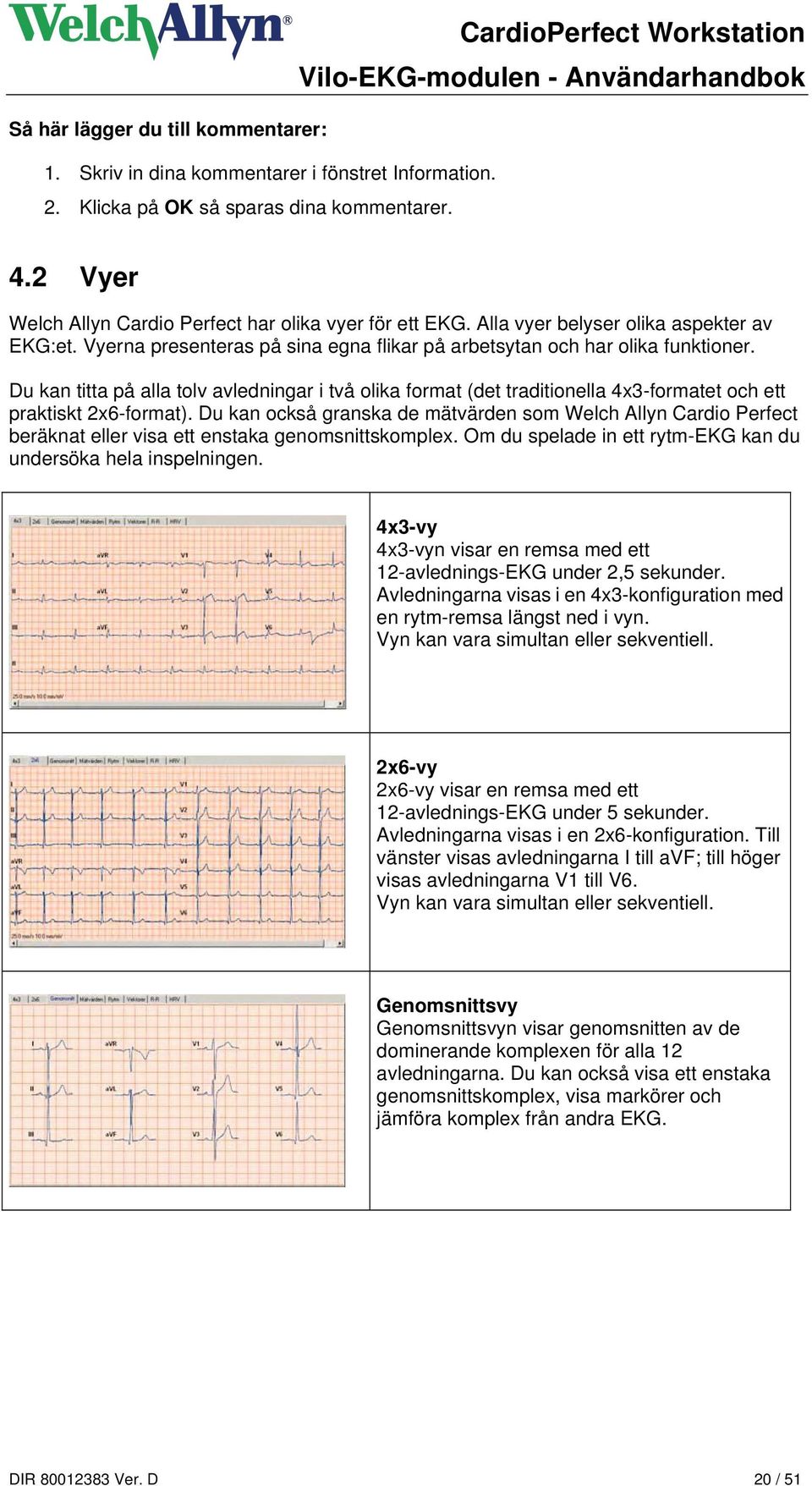 Du kan titta på alla tolv avledningar i två olika format (det traditionella 4x3-formatet och ett praktiskt 2x6-format).