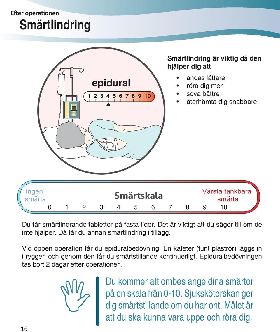 Då får du annan smärtlindring i tillägg. Vid öppen operation får du epiduralbedövning. En kateter (tunt plaströr) läggs in i ryggen och genom den får du smärtstillande kontinuerligt.