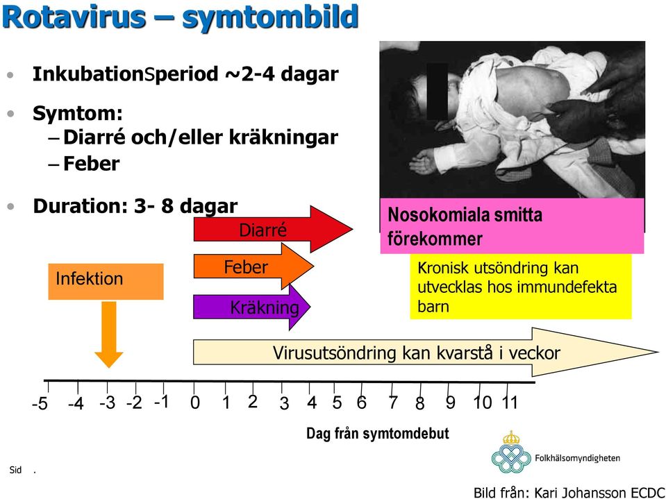 Nosokomiala smitta förekommer Kronisk utsöndring kan utvecklas hos immundefekta barn