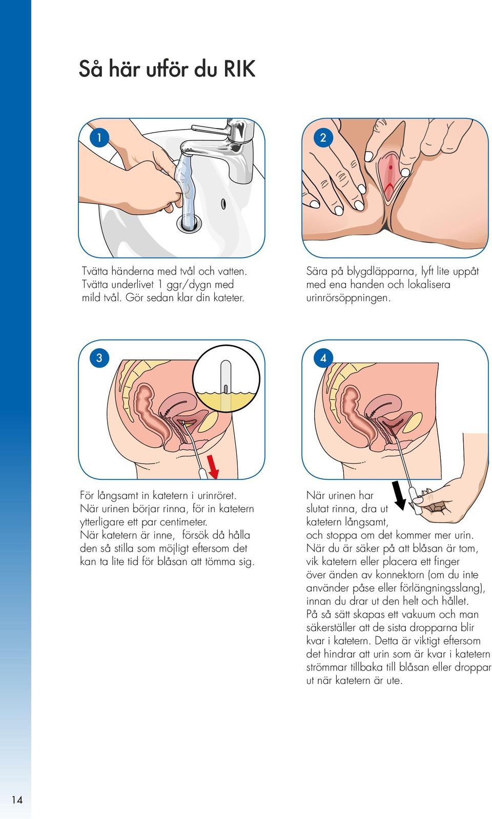 När urinen börjar rinna, för in katetern ytterligare ett par centimeter. När katetern är inne, försök då hålla den så stilla som möjligt eftersom det kan ta lite tid för blåsan att tömma sig.