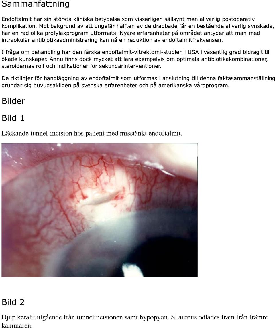 Nyare erfarenheter på området antyder att man med intraokulär antibiotikaadministrering kan nå en reduktion av endoftalmitfrekvensen.