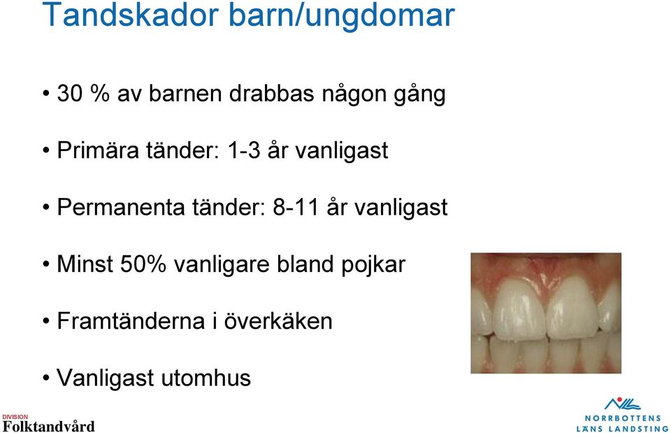 Permanenta tänder: 8-11 år vanligast Minst 50%