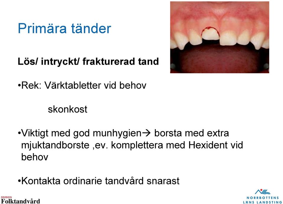 munhygien borsta med extra mjuktandborste,ev.