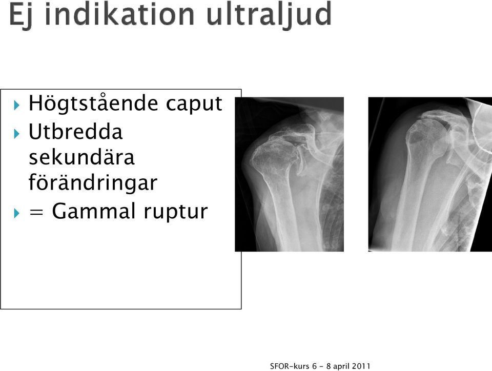 sekundära