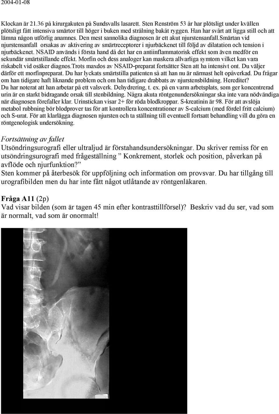 smärtan vid njurstensanfall orsakas av aktivering av smärtreceptorer i njurbäckenet till följd av dilatation och tension i njurbäckenet.