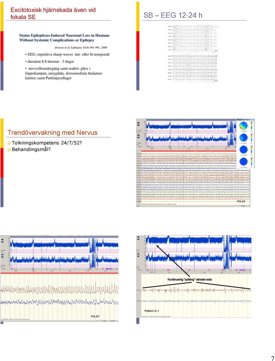 Epilepsia 41(8) 981-991, 2000 EEG: repetitiva sharp-waves uni- eller bi-temporalt duration 8.
