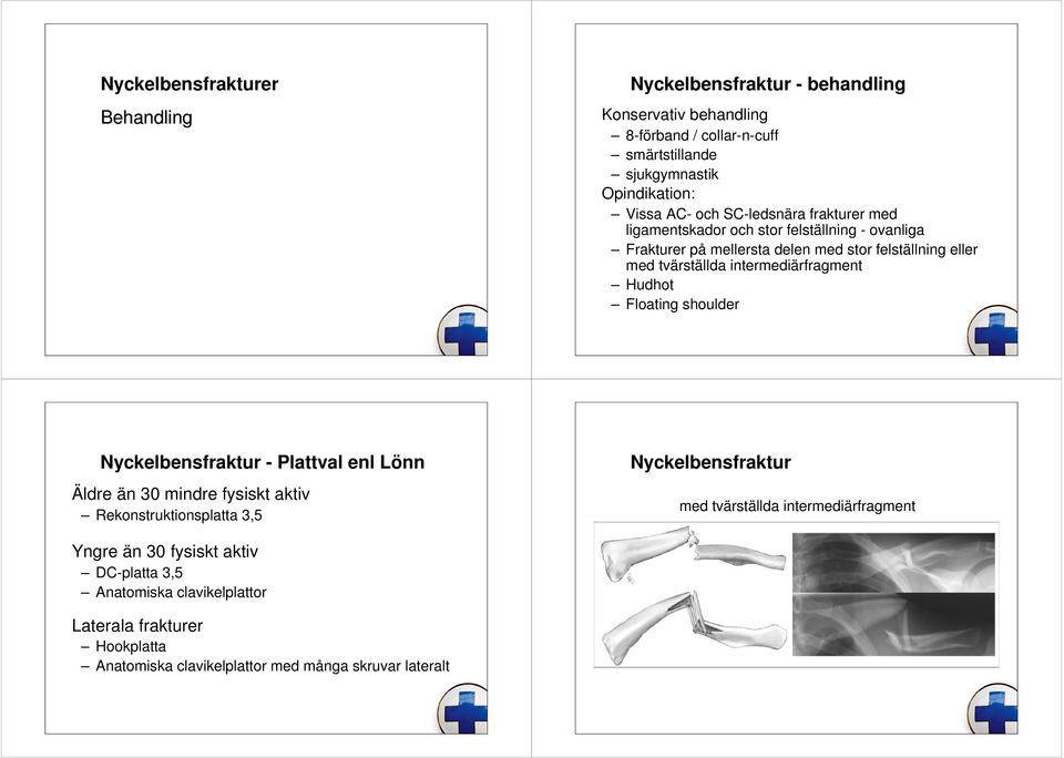 Hudhot Floating shoulder Nyckelbensfraktur - Plattval enl Lönn Äldre än 30 mindre fysiskt aktiv Rekonstruktionsplatta 3,5 Nyckelbensfraktur med tvärställda