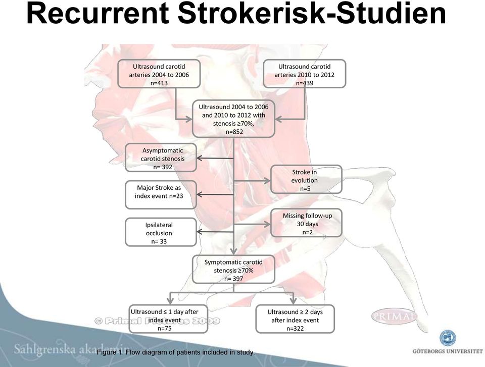 event n=23 Ipsilateral occlusion n= 33 Stroke in evolution n=5 Missing follow-up 30 days n=2 Symptomatic carotid stenosis 70% n=