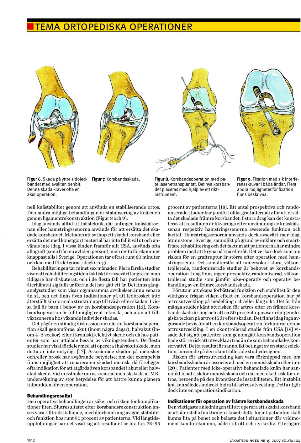 nell knästabilitet genom att använda en stabiliserande ortos. Den andra möjliga behandlingen är stabilisering av knäleden genom ligamentrekonstruktion (Figur 8 och 9).