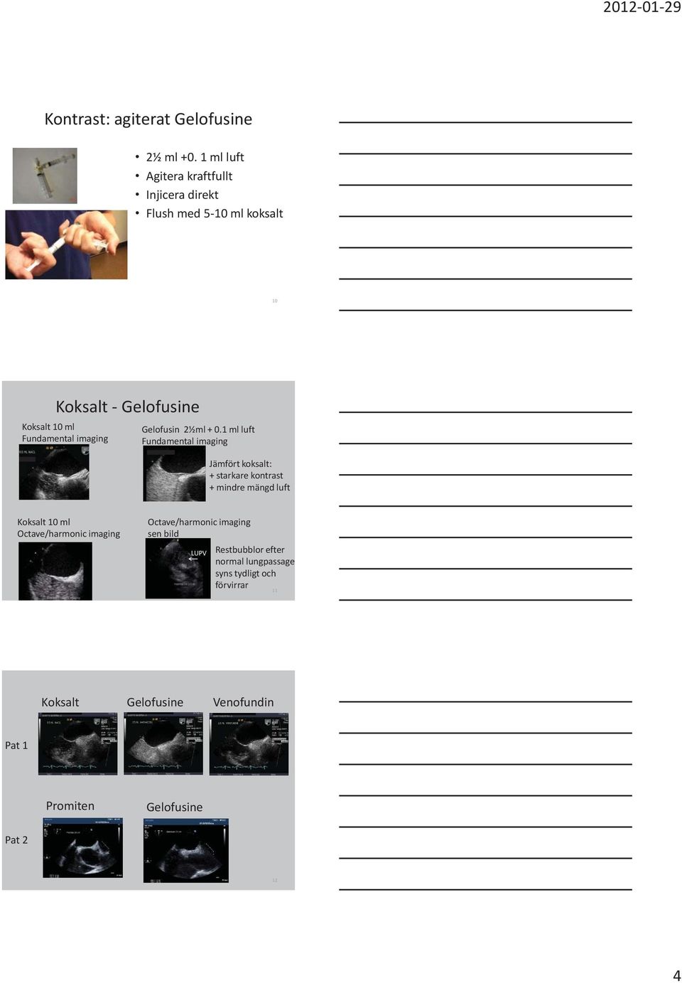 imaging Gelofusin 2½ml + 0.