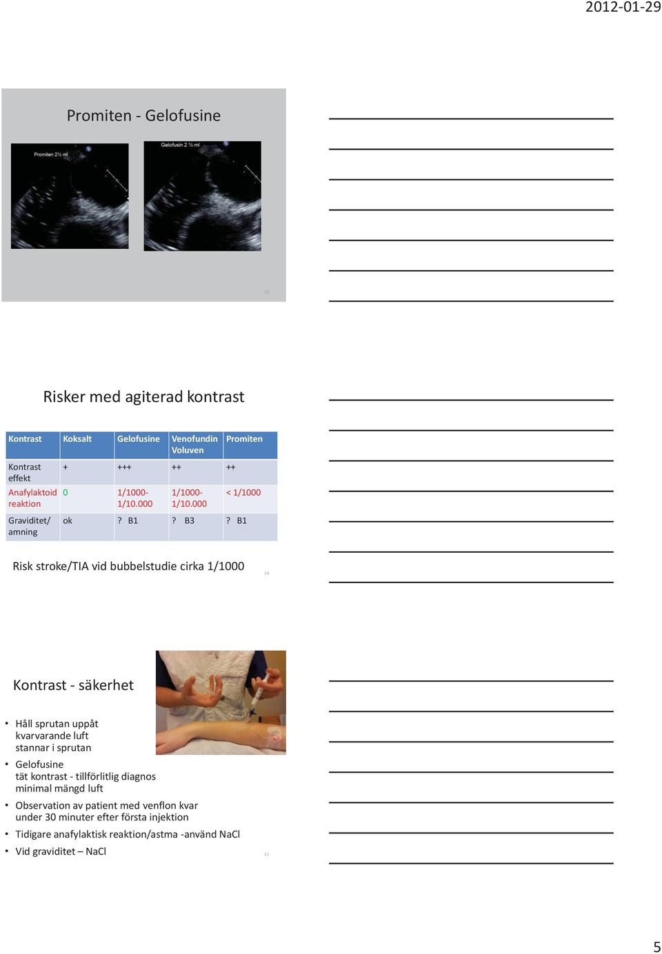 B1 Risk stroke/tia vid bubbelstudie cirka 1/1000 14 Kontrast - säkerhet Håll sprutan uppåt kvarvarande luft stannar i sprutan Gelofusine tät