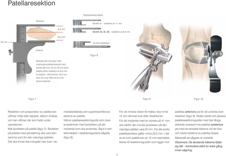 Figur 7 Figur 9 Figur 10 Resektion och preparation av patella kan utföras i följd eller separat, såsom önskas, och kan utföras när som helst under operationen. Mät tjockleken på patella (figur 7).