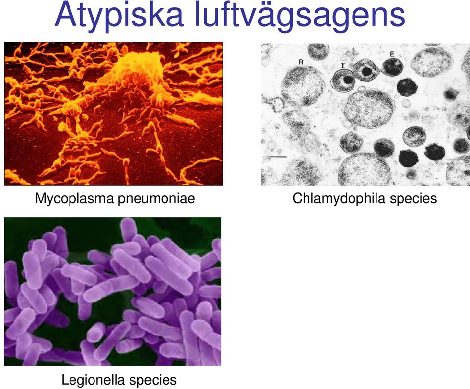 Chlamydophila species 