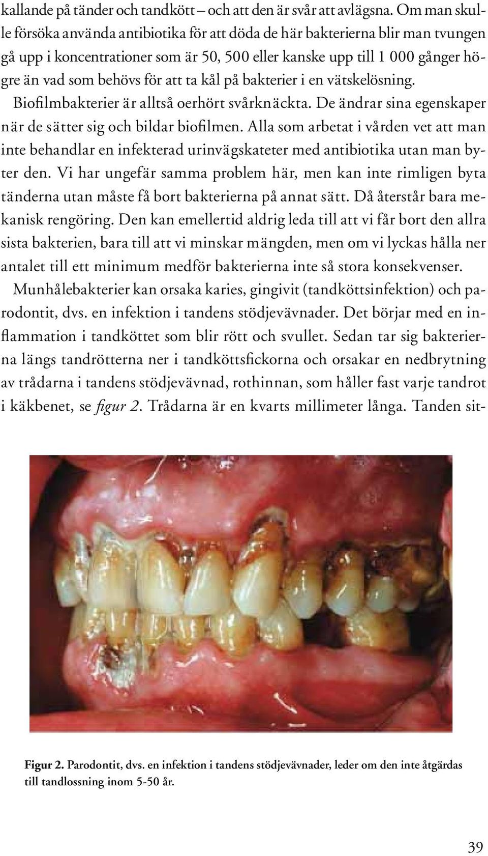 ta kål på bakterier i en vätskelösning. Biofi lmbakterier är alltså oerhört svårknäckta. De ändrar sina egenskaper när de sätter sig och bildar biofi lmen.