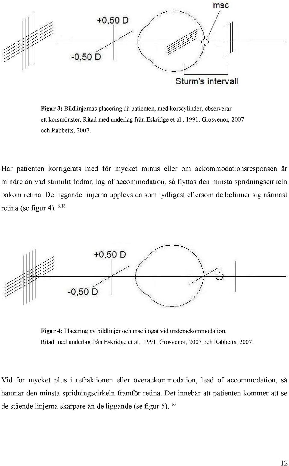 De liggande linjerna upplevs då som tydligast eftersom de befinner sig närmast retina (se figur 4). 6,16 Figur 4: Placering av bildlinjer och msc i ögat vid underackommodation.