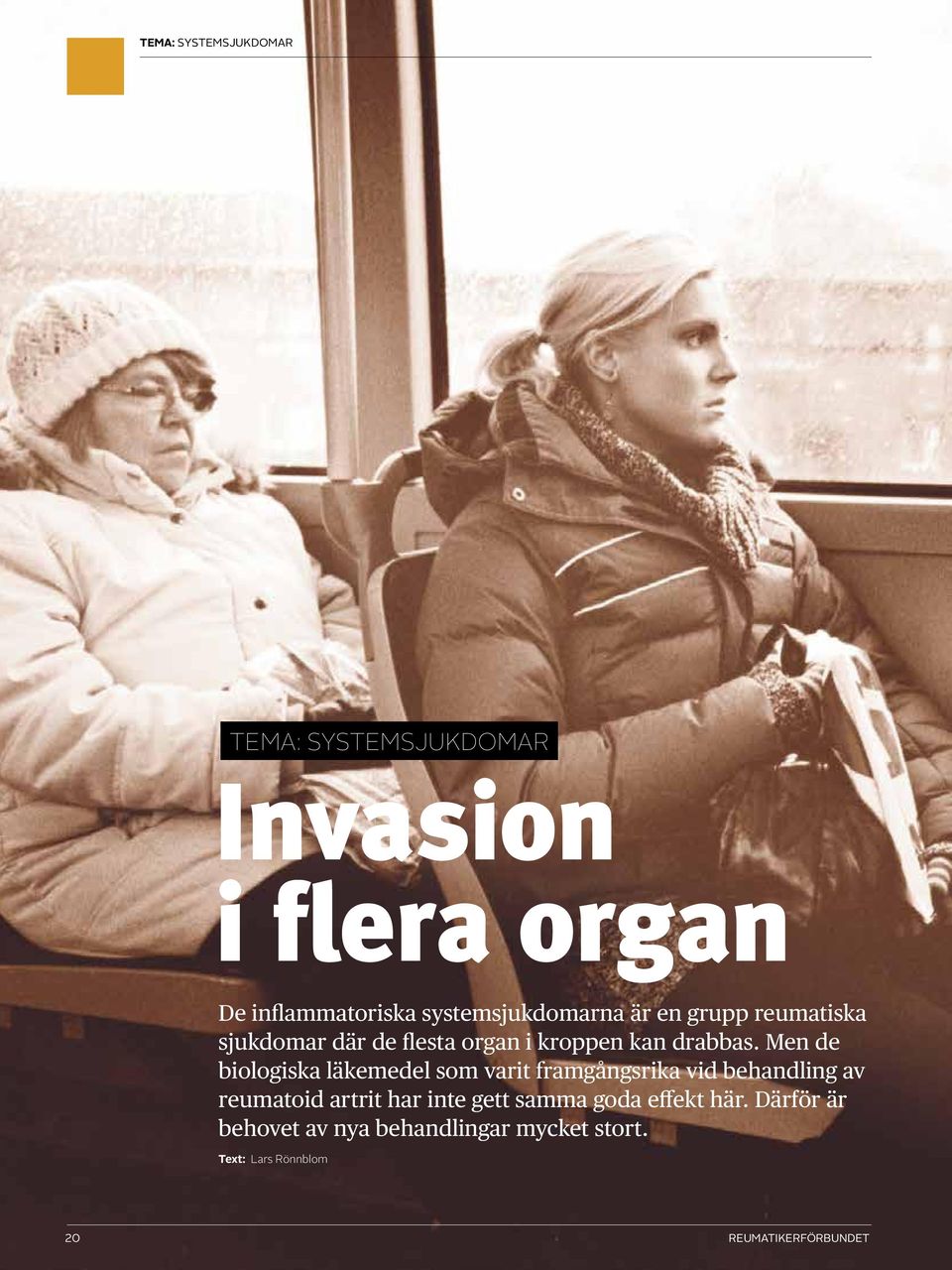 Men de biologiska läkemedel som varit framgångsrika vid behandling av reumatoid artrit har inte