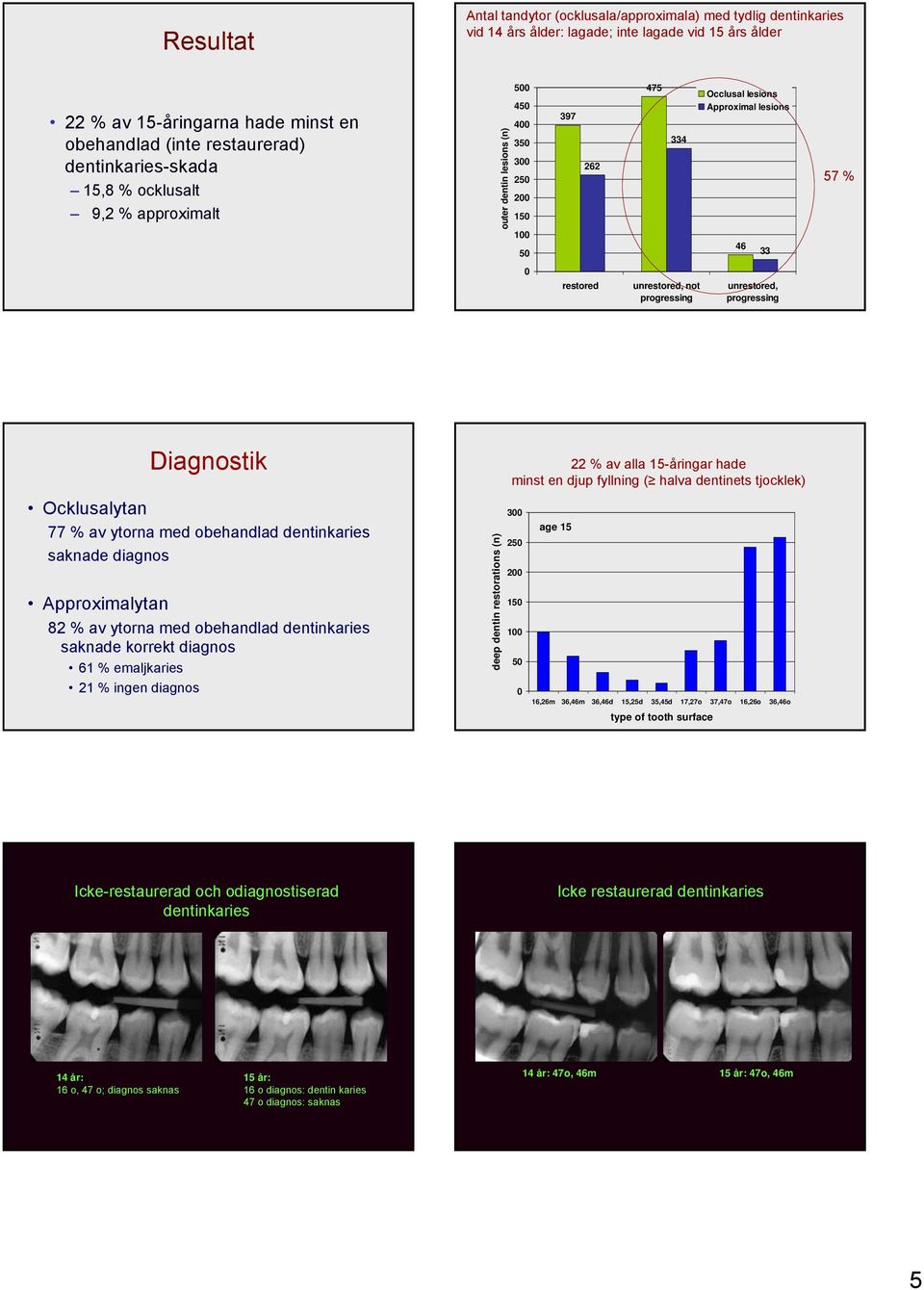 unrestored, not progressing unrestored, progressing Diagnostik Ocklusalytan 77 % av ytorna med obehandlad dentinkaries saknade diagnos Approximalytan 82 % av ytorna med obehandlad dentinkaries