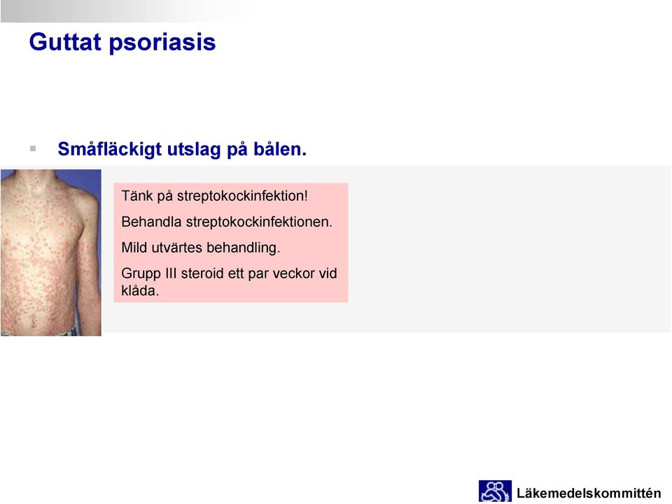 Behandla streptokockinfektionen.