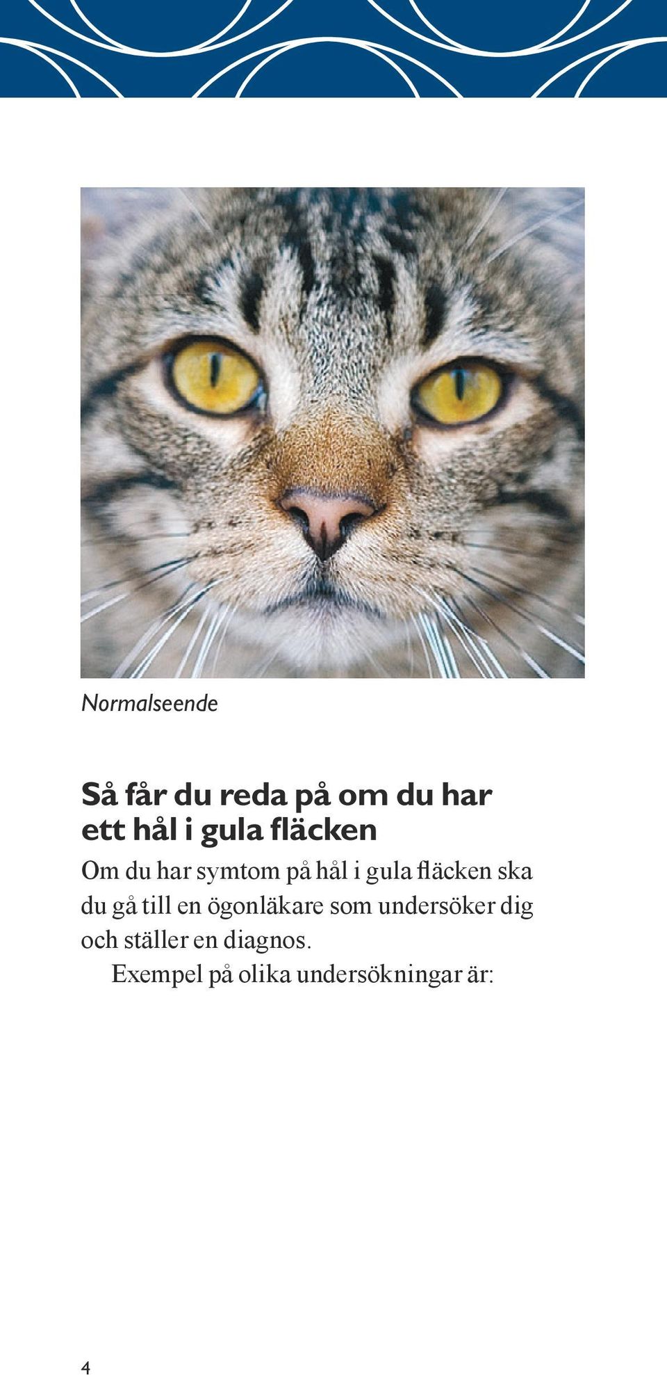 ska du gå till en ögonläkare som undersöker dig och