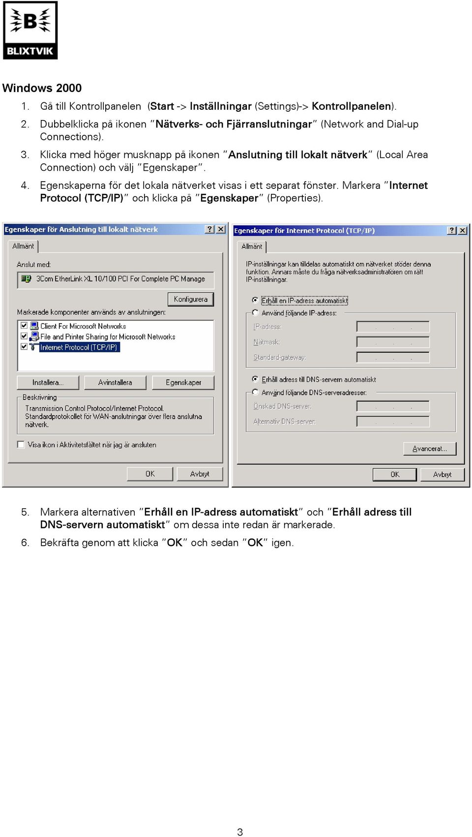 Egenskaperna för det lokala nätverket visas i ett separat fönster. Markera Internet Protocol (TCP/IP) och klicka på Egenskaper (Properties). 5.