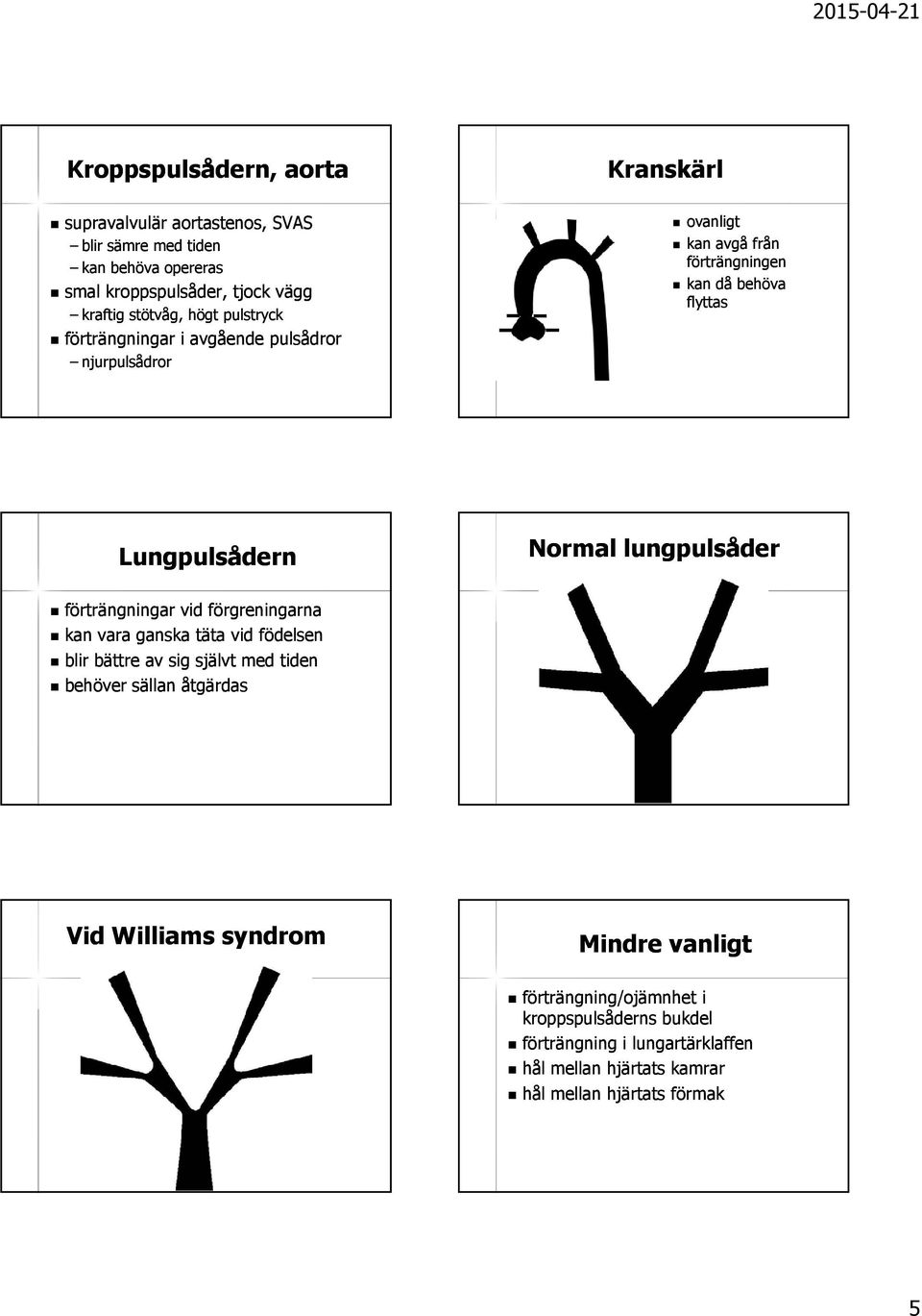 lungpulsåder förträngningar vid förgreningarna kan vara ganska täta vid födelsen blir bättre av sig självt med tiden behöver sällan åtgärdas Vid Williams