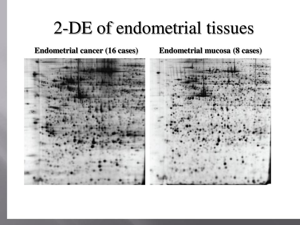 cancer (16 cases)