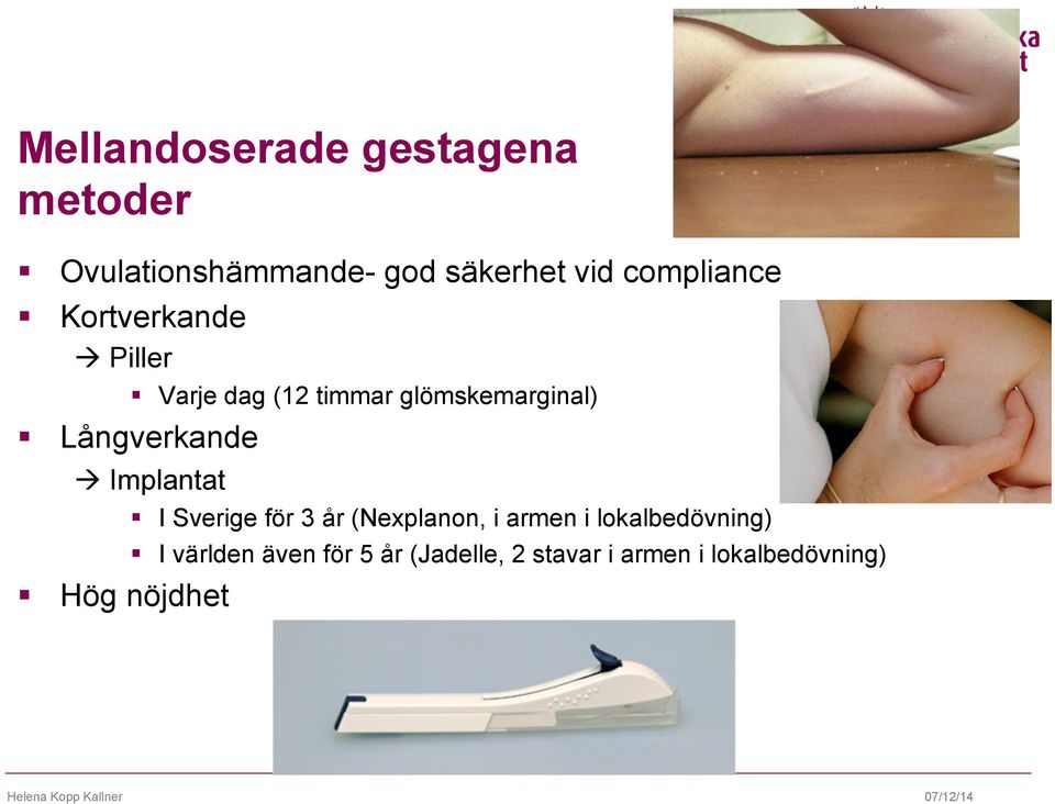 Implantat I Sverige för 3 år (Nexplanon, i armen i lokalbedövning) I världen även
