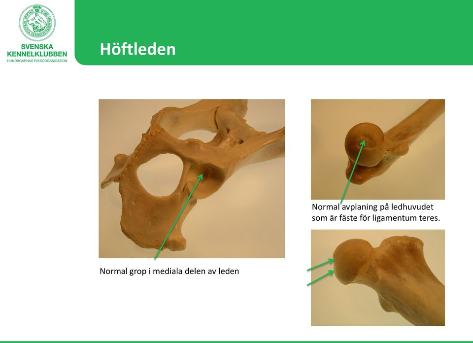 för ligamentum teres.