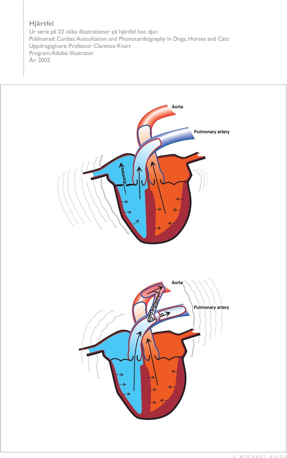 Publicerad: Cardiac Auscultation and Phonocardiography