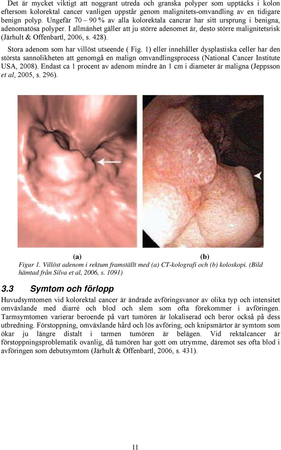 428). Stora adenom som har villöst utseende ( Fig. 1) eller innehåller dysplastiska celler har den största sannolikheten att genomgå en malign omvandlingsprocess (National Cancer Institute USA, 2008).