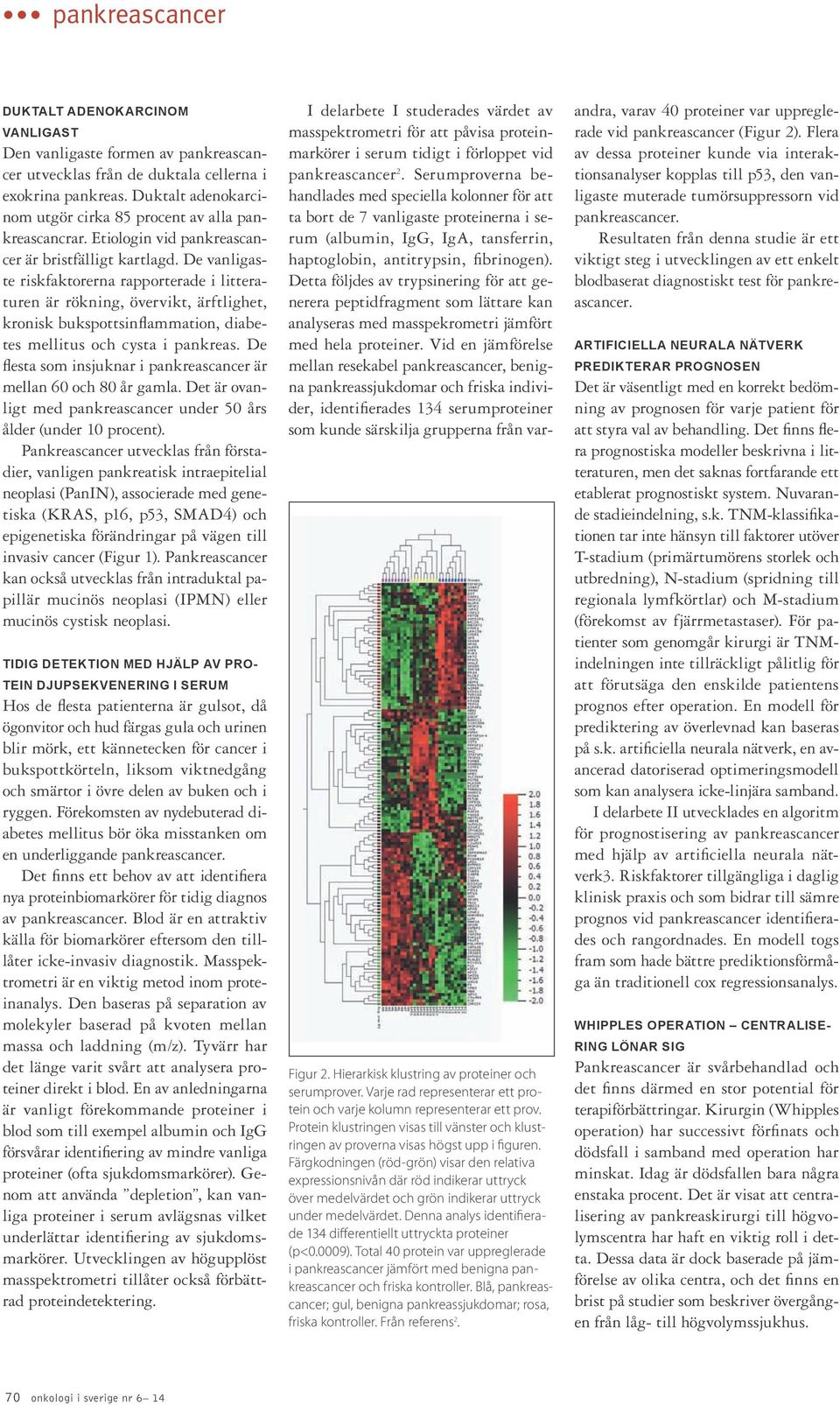 De vanligaste riskfaktorerna rapporterade i litteraturen är rökning, övervikt, ärftlighet, kronisk bukspottsinflammation, diabetes mellitus och cysta i pankreas.