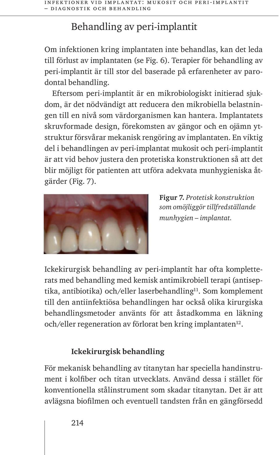 Eftersom peri-implantit är en mikrobiologiskt initierad sjukdom, är det nödvändigt att reducera den mikrobiella belastningen till en nivå som värdorganismen kan hantera.