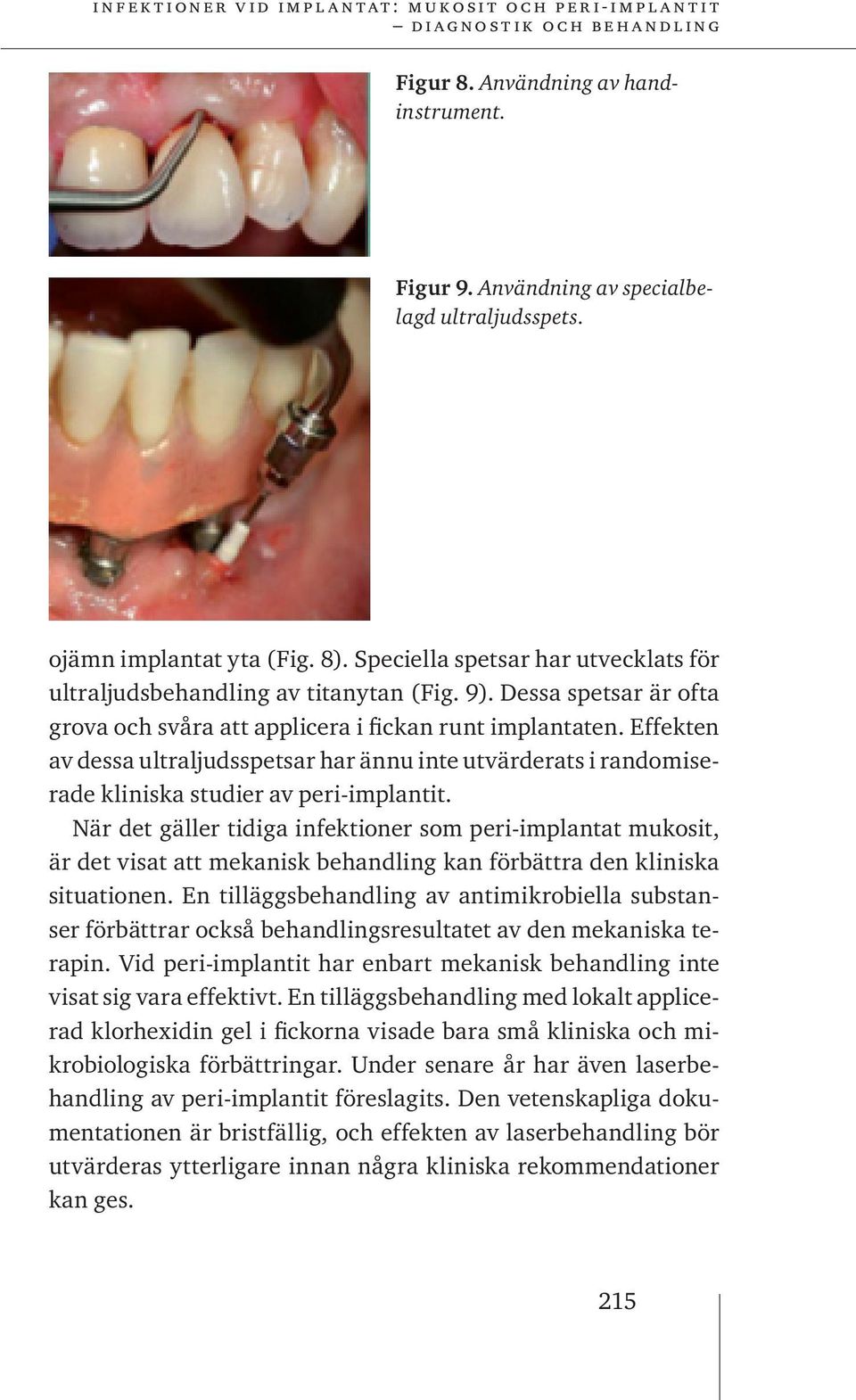 När det gäller tidiga infektioner som peri-implantat mukosit, är det visat att mekanisk behandling kan förbättra den kliniska situationen.