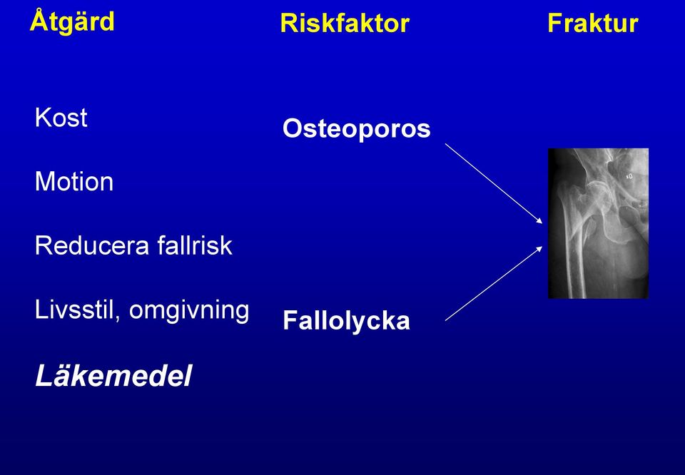 fallrisk Livsstil,