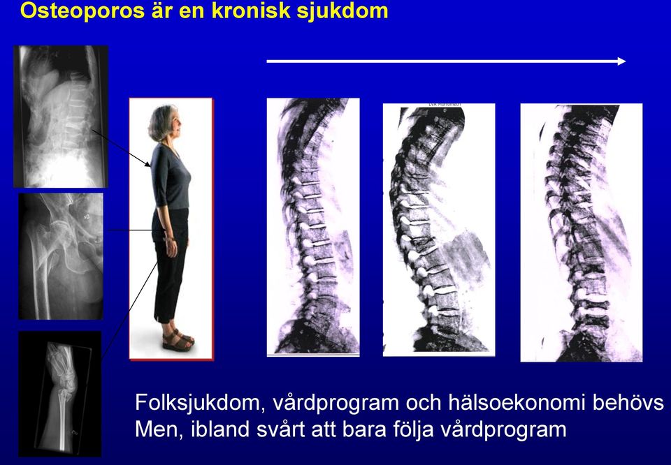 vårdprogram och hälsoekonomi