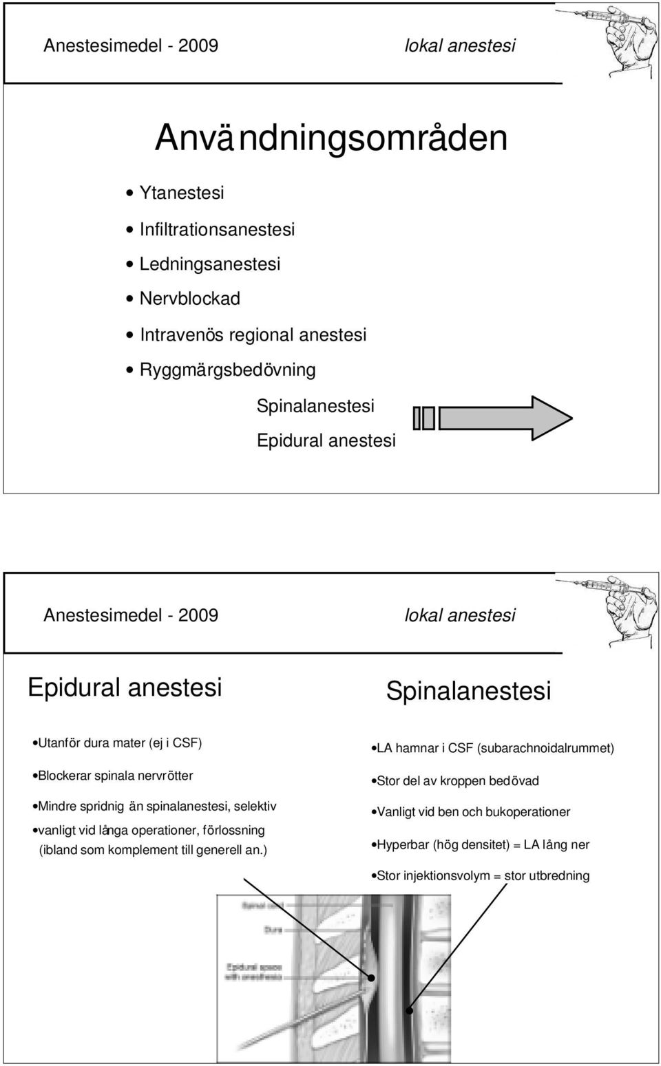 än spinalanestesi, selektiv vanligt vid långa operationer, förlossning (ibland som komplement till generell an.