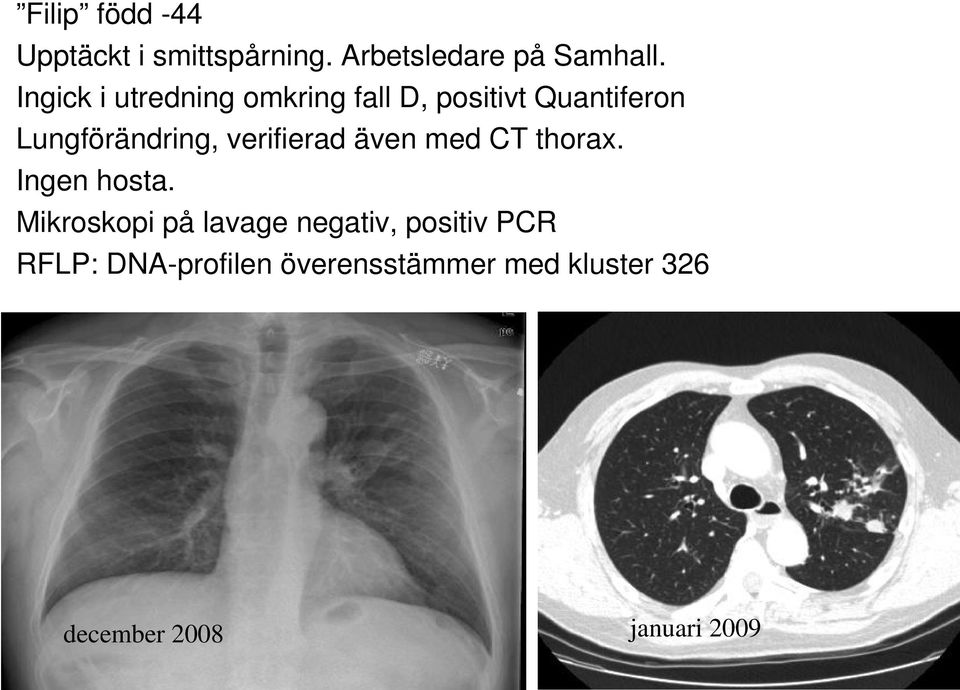 verifierad även med CT thorax. Ingen hosta.