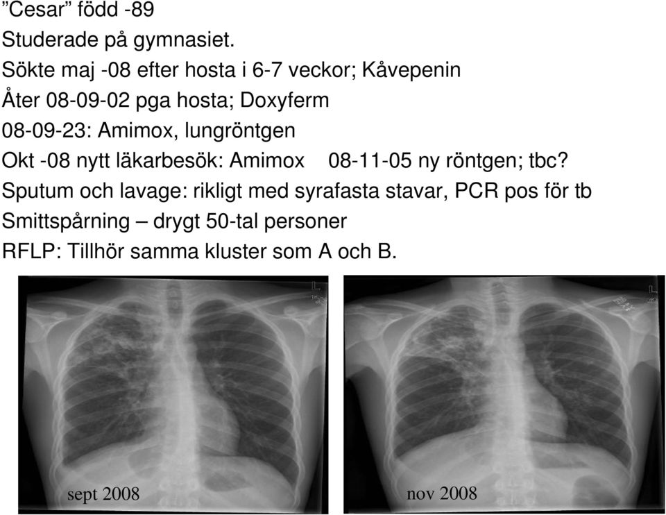 08-09-23: Amimox, lungröntgen Okt -08 nytt läkarbesök: Amimox 08-11-05 ny röntgen; tbc?